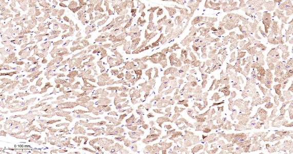 人环氧合酶2即用型免疫组化试剂盒-IHC0408H